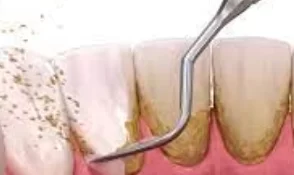 Periodontia